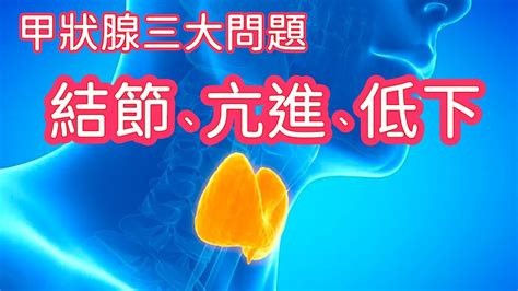 施銘朗醫師評價|[問題] 甲狀腺開刀選擇